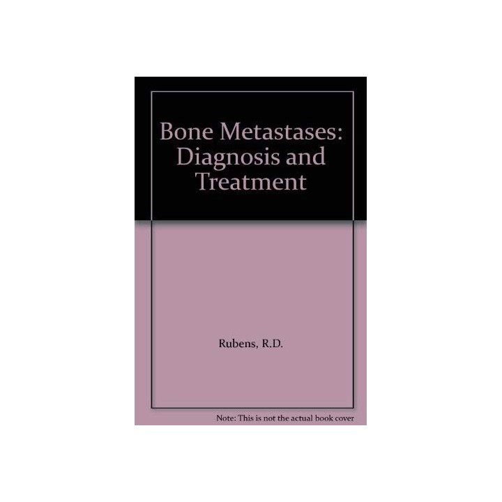 Bone Metastases: Diagnosis And Treatment